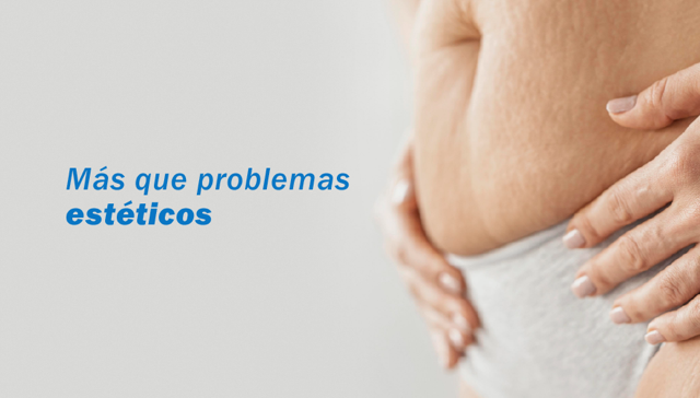 ¿Qué indican las estrías, rayas o cambio de color en las uñas?