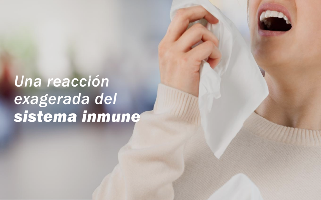 3 formas naturales de reducir los síntomas de alergias