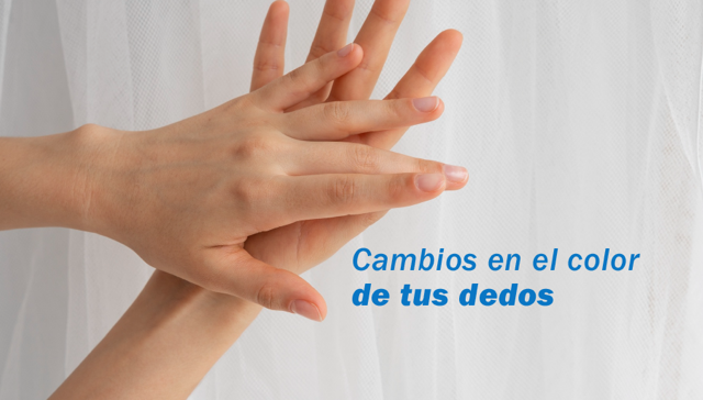 Síndrome de Raynaud