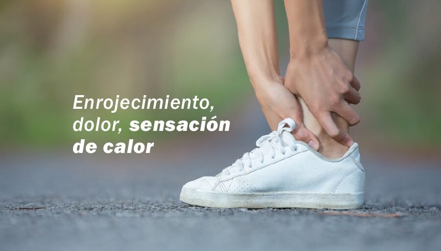 ¿Es bueno caminar con flebitis?